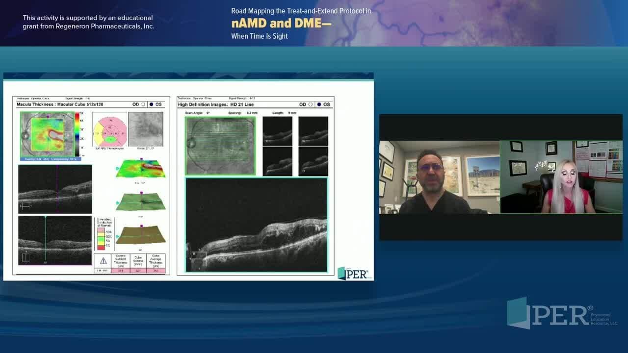 Road Mapping the Treat-and-Extend Protocol in nAMD and DME – When Time Is Sight – Dr. Major Case 1