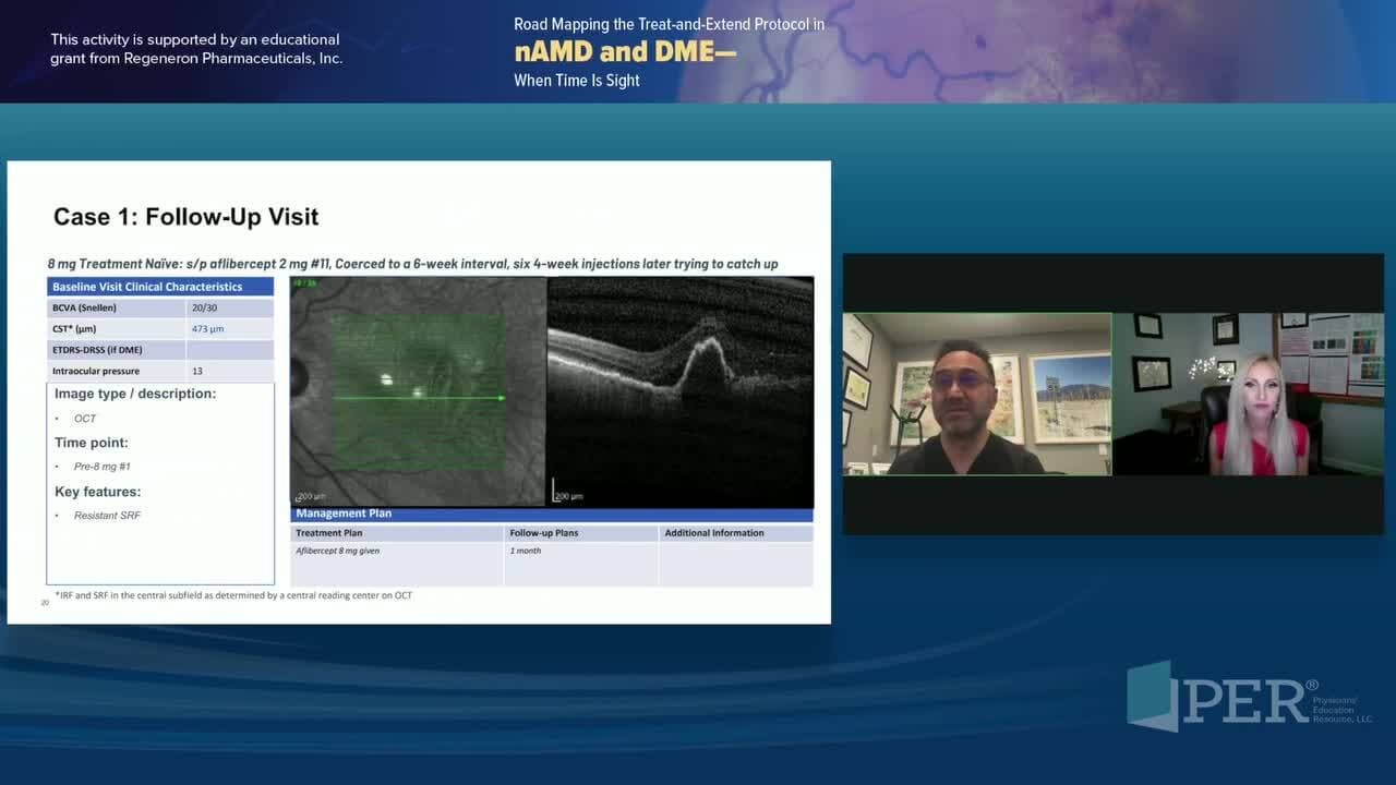 Road Mapping the Treat-and-Extend Protocol in nAMD and DME – When Time Is Sight – Dr. Javahari Case