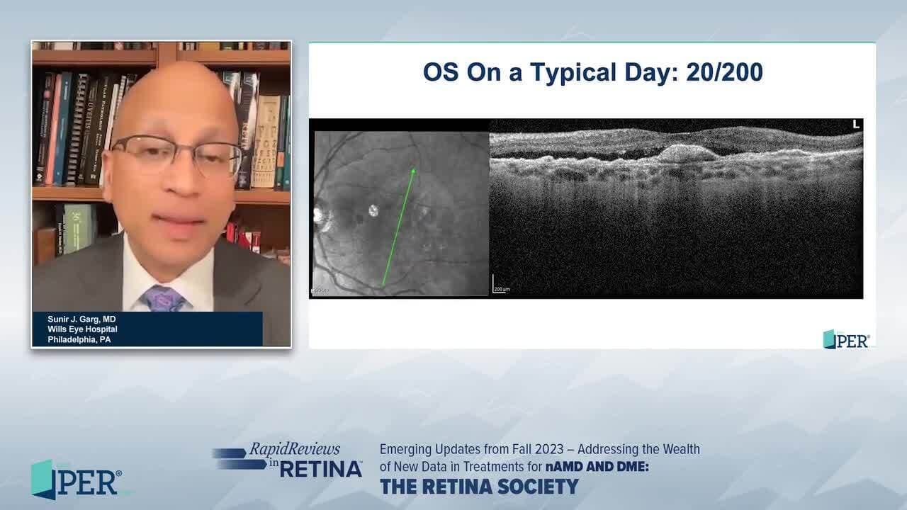 Rapid Reviews in Retina Emerging Updates from Fall 2023 – Addressing the Wealth of New Data in Treatments for nAMD and DME – The RETINA Society